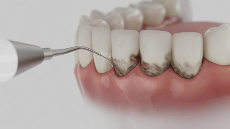 Reliable Dental Implants contractor in Level Plains, AL by Smile Center Dentistry